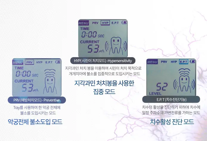 불소이온도입기